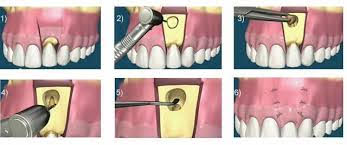 Chirurgia orale & Implantologia