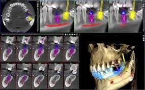 Chirurgia orale & Implantologia